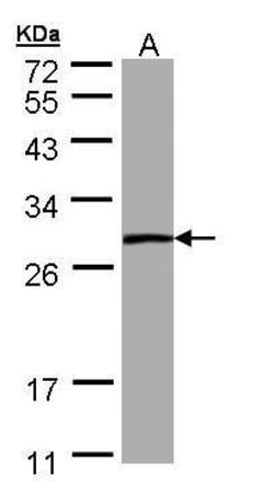 Invitrogen PSPH Polyclonal Antibody 100 &mu;L; Unconjugated:Anticorps,