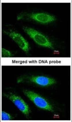 Invitrogen ETFB Polyclonal Antibody 100 &mu;L; Unconjugated:Antibodies,
