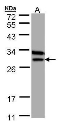 Invitrogen ETFB Polyclonal Antibody 100 &mu;L; Unconjugated:Antibodies,