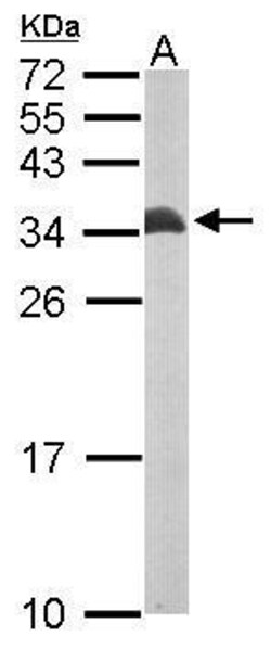 Invitrogen ETFB Polyclonal Antibody 100 &mu;L; Unconjugated:Antibodies,