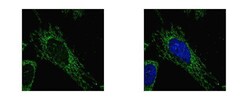Invitrogen SUCLG1 Polyclonal Antibody 100 &mu;L; Unconjugated:Antibodies,