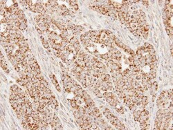 Invitrogen SUCLG1 Polyclonal Antibody 100 &mu;L; Unconjugated:Antibodies,