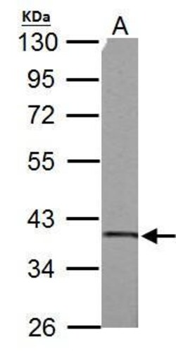 Invitrogen SUCLG1 Polyclonal Antibody 100 &mu;L; Unconjugated:Antibodies,