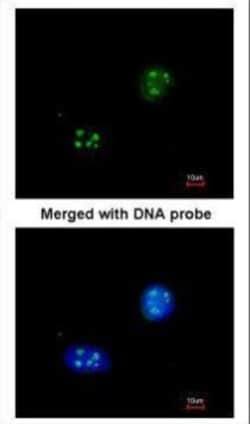 Invitrogen NHP2L1 Polyclonal Antibody 100 &mu;L; Unconjugated:Antibodies,