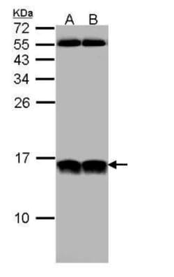 Invitrogen NHP2L1 Polyclonal Antibody 100 &mu;L; Unconjugated:Antibodies,
