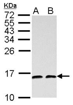 Invitrogen NHP2L1 Polyclonal Antibody 100 &mu;L; Unconjugated:Antibodies,