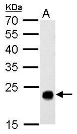 Invitrogen GSTT1 Polyclonal Antibody 100 &mu;L; Unconjugated:Antibodies,