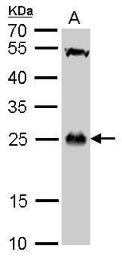 Invitrogen GSTT1 Polyclonal Antibody 100 &mu;L; Unconjugated:Antibodies,