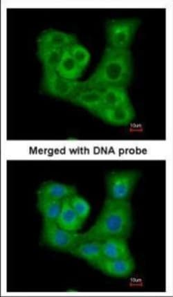 Invitrogen DUSP7 Polyclonal Antibody 100 &mu;L; Unconjugated:Antibodies,