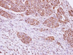 Invitrogen DUSP7 Polyclonal Antibody 100 &mu;L; Unconjugated:Antibodies,