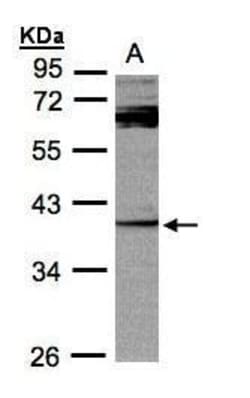 Invitrogen DUSP7 Polyclonal Antibody 100 &mu;L; Unconjugated:Antibodies,