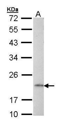 Invitrogen AP1S2 Polyclonal Antibody 100 &mu;L; Unconjugated:Antibodies,