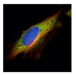 Invitrogen EPHX1 Polyclonal Antibody 100 &mu;L | Buy Online | Invitrogen&trade; | Fisher Scientific