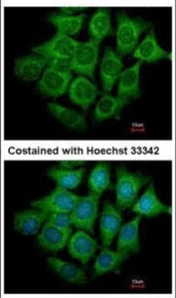 Invitrogen UBE4B Polyclonal Antibody 100 &mu;L; Unconjugated:Antibodies,