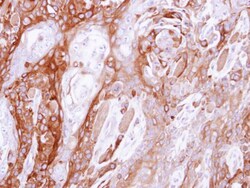 Invitrogen UBE4B Polyclonal Antibody 100 &mu;L; Unconjugated:Antibodies,