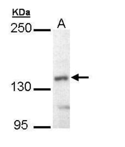 Invitrogen UBE4B Polyclonal Antibody 100 &mu;L; Unconjugated:Antibodies,