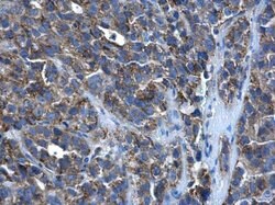 Invitrogen PEX26 Polyclonal Antibody 100 &mu;L | Buy Online | Invitrogen&trade; | Fisher Scientific