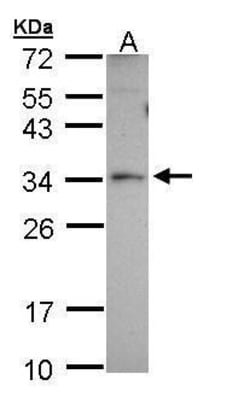 Invitrogen PEX26 Polyclonal Antibody 100 &mu;L | Buy Online | Invitrogen&trade; | Fisher Scientific