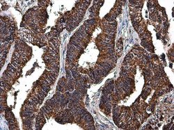 Invitrogen LRP130 Polyclonal Antibody 100 &mu;L | Buy Online | Invitrogen&trade; | Fisher Scientific