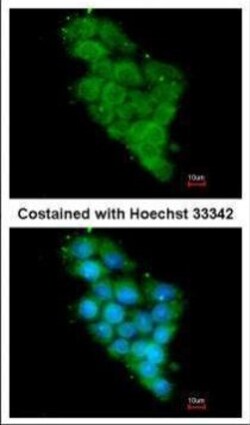 Invitrogen NDUFA12 Polyclonal Antibody 100 &mu;L; Unconjugated:Antibodies,