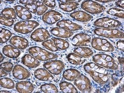 Invitrogen NDUFA12 Polyclonal Antibody 100 &mu;L; Unconjugated:Antibodies,