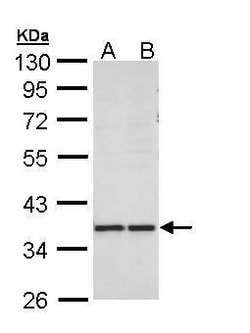 Invitrogen AKR1B10 Polyclonal Antibody 100 &mu;L; Unconjugated:Antibodies,