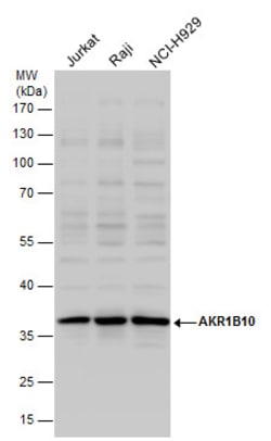Invitrogen AKR1B10 Polyclonal Antibody 100 &mu;L; Unconjugated:Antibodies,