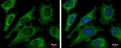 Invitrogen DECR1 Polyclonal Antibody 100 &mu;L; Unconjugated:Antibodies,