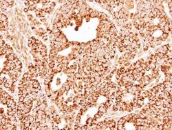 Invitrogen DECR1 Polyclonal Antibody 100 &mu;L; Unconjugated:Antibodies,
