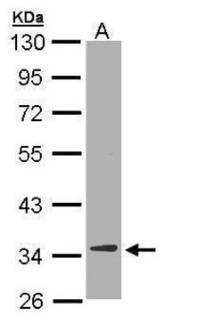 Invitrogen DECR1 Polyclonal Antibody 100 &mu;L; Unconjugated:Antibodies,