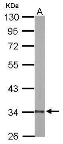 Invitrogen DECR1 Polyclonal Antibody 100 &mu;L; Unconjugated:Antibodies,