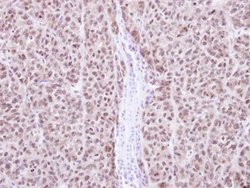 Invitrogen RAG2 Polyclonal Antibody 100 &mu;L | Buy Online | Invitrogen&trade; | Fisher Scientific