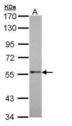 Invitrogen RAG2 Polyclonal Antibody 100 &mu;L | Buy Online | Invitrogen&trade; | Fisher Scientific