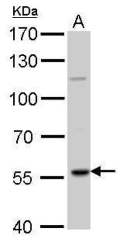 Invitrogen RAG2 Polyclonal Antibody 100 &mu;L | Buy Online | Invitrogen&trade; | Fisher Scientific
