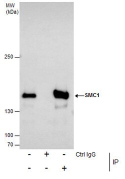 Invitrogen SMC1 Polyclonal Antibody 100 &mu;L; Unconjugated:Antibodies,