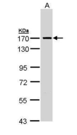 Invitrogen SMC1 Polyclonal Antibody 100 &mu;L; Unconjugated:Antibodies,