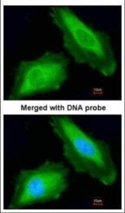 Invitrogen DDX3Y Polyclonal Antibody 100 &mu;L; Unconjugated:Antibodies,
