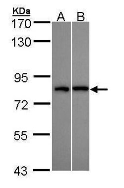 Invitrogen DDX3Y Polyclonal Antibody 100 &mu;L; Unconjugated:Antibodies,