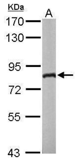 Invitrogen DDX3Y Polyclonal Antibody 100 &mu;L; Unconjugated:Antibodies,