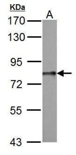 Invitrogen DDX3Y Polyclonal Antibody 100 &mu;L; Unconjugated:Antibodies,