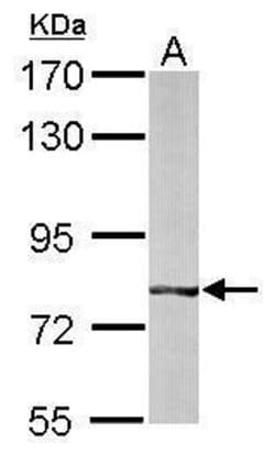 Invitrogen BBS7 Polyclonal Antibody 100 &mu;L; Unconjugated:Antibodies,