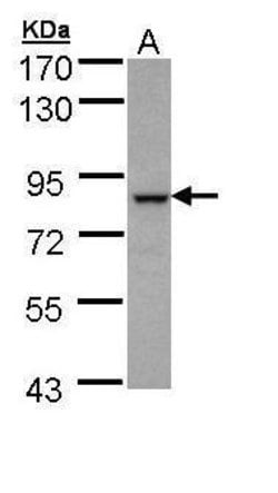 Invitrogen BBS7 Polyclonal Antibody 100 &mu;L; Unconjugated:Antibodies,