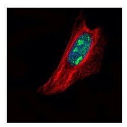 Invitrogen TSPYL1 Polyclonal Antibody 100 &mu;L; Unconjugated:Antibodies,