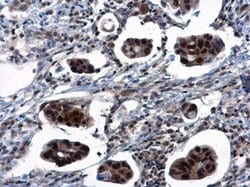 Invitrogen TSPYL1 Polyclonal Antibody 100 &mu;L; Unconjugated:Antibodies,