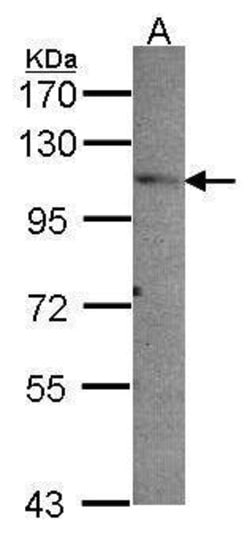 Invitrogen PEX6 Polyclonal Antibody 100 &mu;L; Unconjugated:Antibodies,