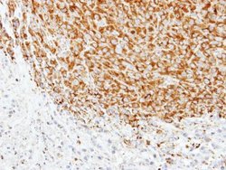 Invitrogen TUBA1A Polyclonal Antibody 100 &mu;L | Buy Online | Invitrogen&trade; | Fisher Scientific