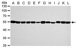 Invitrogen TUBA1A Polyclonal Antibody 100 &mu;L | Buy Online | Invitrogen&trade; | Fisher Scientific