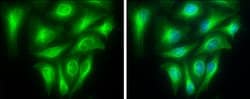 Invitrogen TUBA1A Polyclonal Antibody 100 &mu;L | Buy Online | Invitrogen&trade; | Fisher Scientific