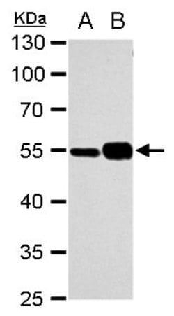 Invitrogen TUBA1A Polyclonal Antibody 100 &mu;L | Buy Online | Invitrogen&trade; | Fisher Scientific