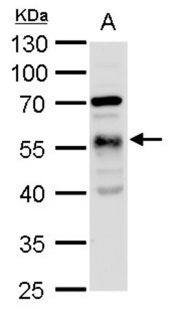 Invitrogen TUBA1A Polyclonal Antibody 100 &mu;L | Buy Online | Invitrogen&trade; | Fisher Scientific